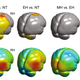 Comparisons of the brain surface shape among Neanderthal, early Homo sapiens, and modern Homo sapiens.